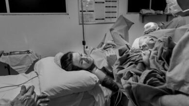 cbd use before surgery